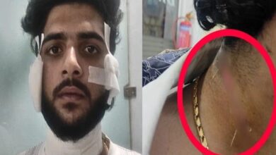 रायपुर सेंट्रल जेल में गैंगवार:  यश शर्मा हत्याकांड के मुख्य गवाह पर जानलेवा हमला, भीतर चला चाकू; कलेक्टर-एसपी से शिकायत - Raipur News