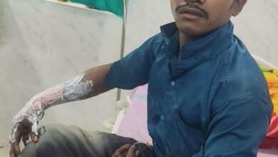 CG: गुस्से की आग में दोस्ती स्वाहा! पत्नी पर टिप्पणी से भड़के युवक ने दोस्त को पेट्रोल डालकर जलाया, गिरफ्तार